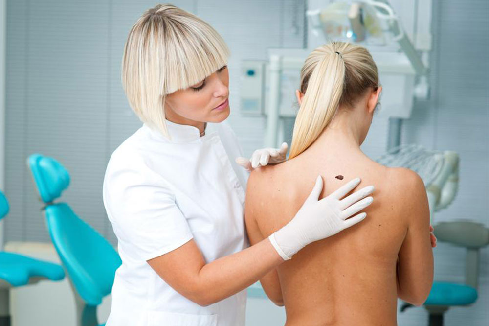 Types and Symptoms of Melanoma
